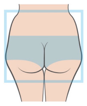 巴西提臀手術-方形臀矯正