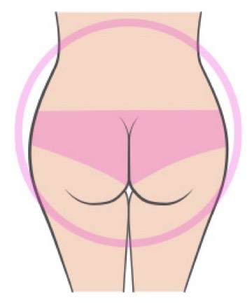 巴西提臀手術-圓形臀矯正