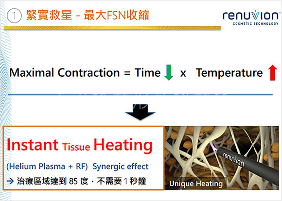 Renuvion超能電漿 Hybrid複合式分層治療概念